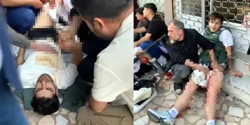 Avcılar'da İnternet Kafe Dehşeti! Bıçaklar Konuştu, 2 Yaralı!