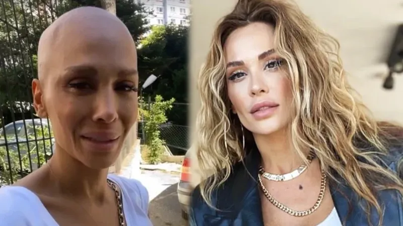 Şimal'den Kanser Tedavisi Sonrası Şoke Eden Paylaşım!