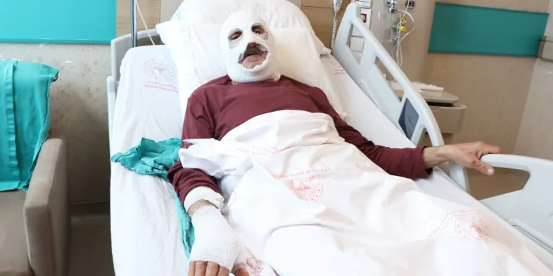Çakmakla Tüp Kontrolü Faciası! Köyde Hastanelik Oldu