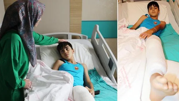 Şaka Faciası! Arkadaşına Kolonya Döküp Yaktı!